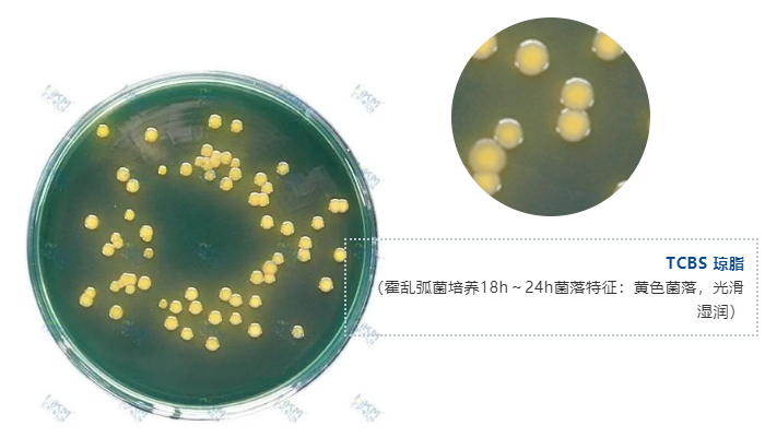 TCBS 瓊脂（霍亂弧菌培養(yǎng)18h～24h菌落特征：黃色菌落，光滑濕潤(rùn)）